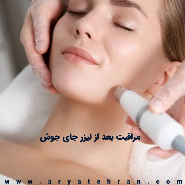 مراقبت بعد از لیزر جای جوش | عوارض بعد از لیزر لک صورت