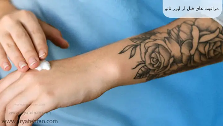 مراقبت های قبل از لیزر تاتو