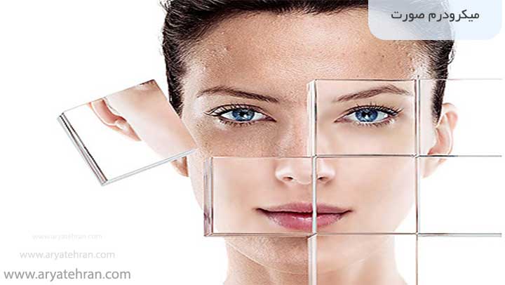 میکرودرم صورت