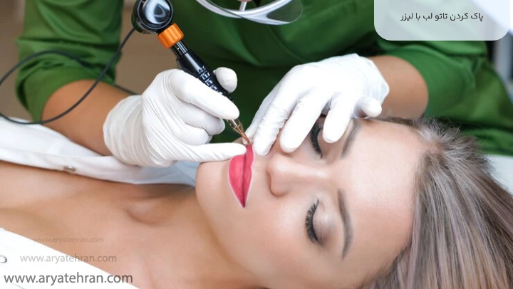 پاک کردن تاتو لب با لیزر