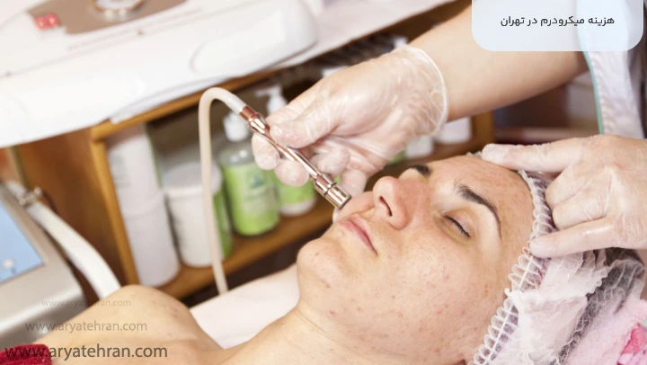 هزینه میکرودرم در تهران