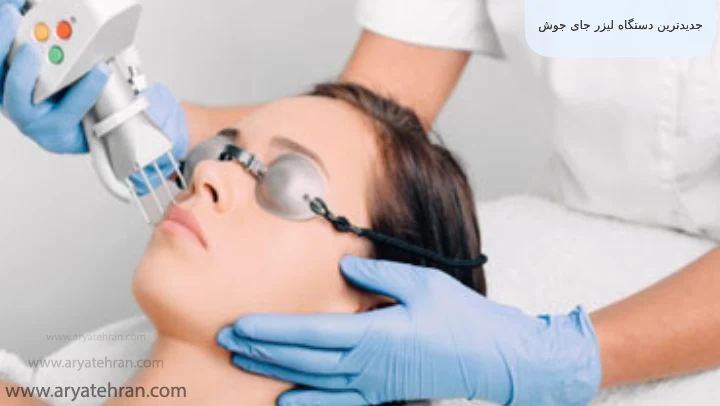 جدیدترین دستگاه لیزر جای جوش