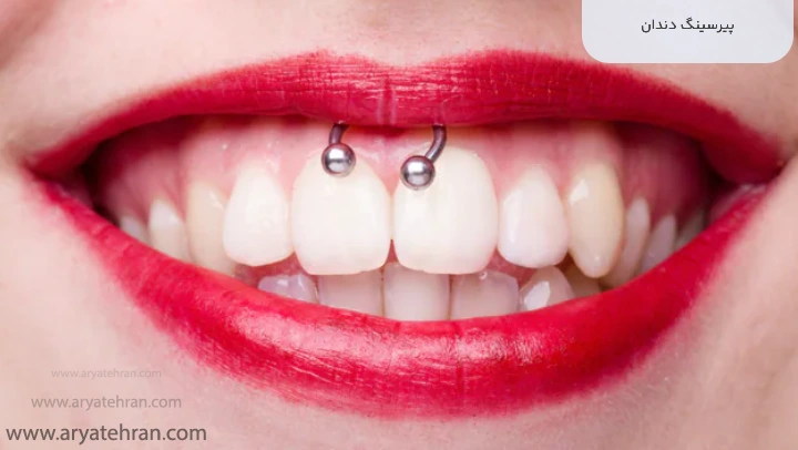 پیرسینگ دندان