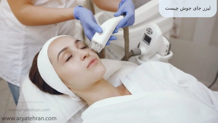 لیزر جای جوش چیست