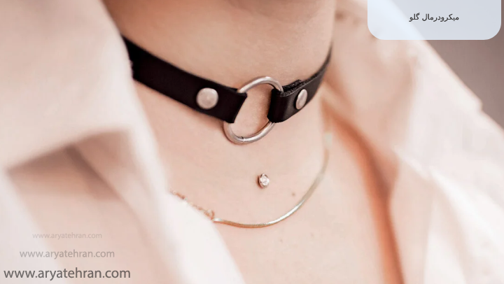 میکرودرمال گلو