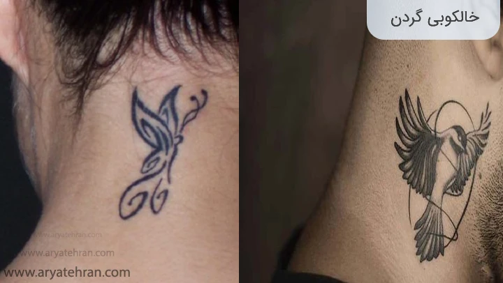 خالکوبی گردن