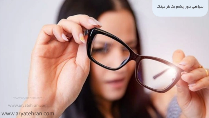 سیاهی دور چشم بخاطر عینک