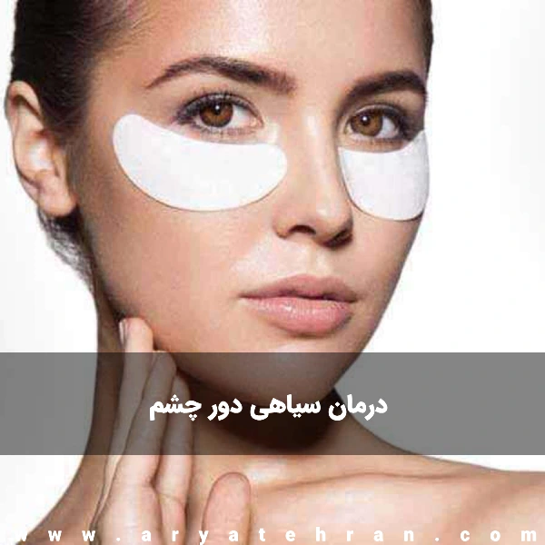 رفع و درمان سیاهی دور چشم | علت سیاهی دور چشم از نظر طب سنتی