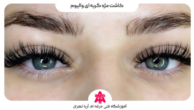 کاشت مژه گربه ای والیوم