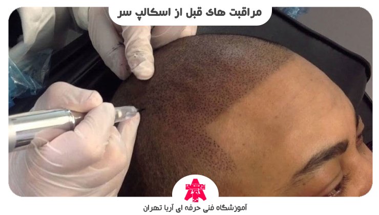 مراقبت های قبل از اسکالپ سر