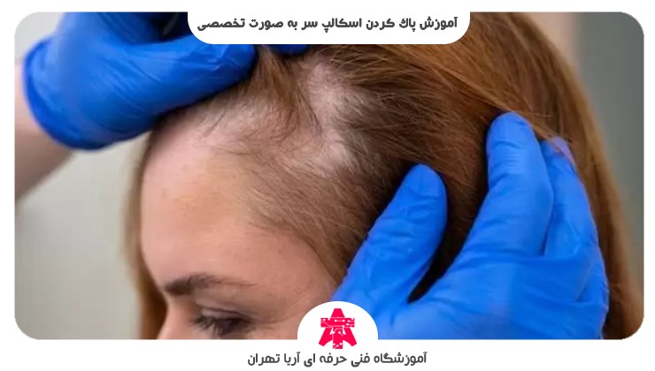 آموزش پاک کردن اسکالپ سر به صورت تخصصی