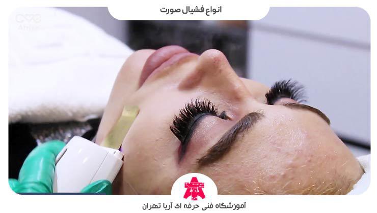 انواع فشیال صورت