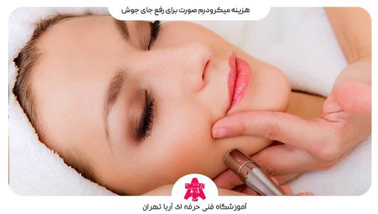 هزینه میکرودرم صورت برای رفع جای جوش