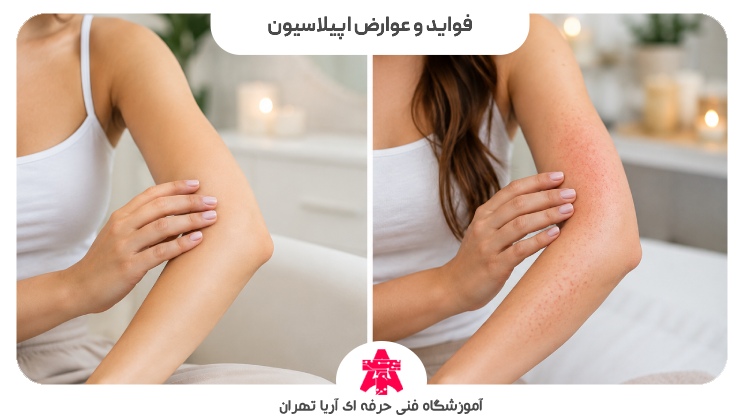 فواید و عوارض اپیلاسیون