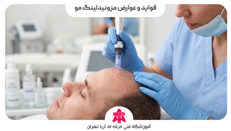فواید و عوارض مزونیدلینگ مو