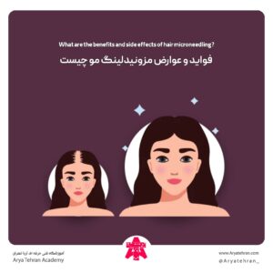 فواید و عوارض مزونیدلینگ مو چیست