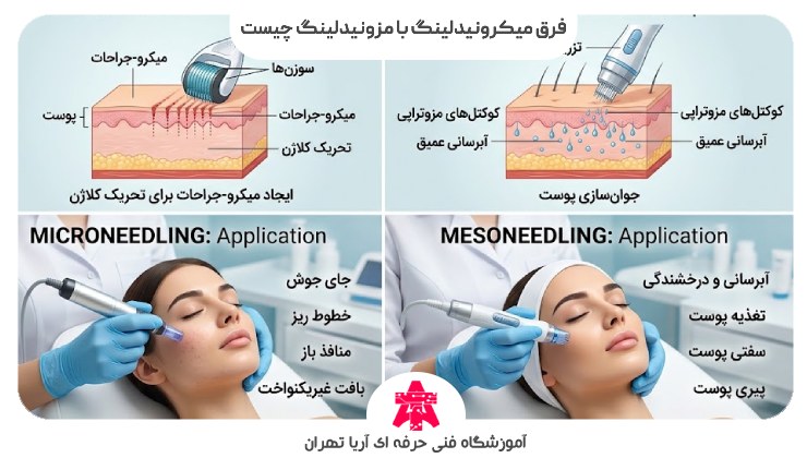 فرق میکرونیدلینگ با مزونیدلینگ چیست