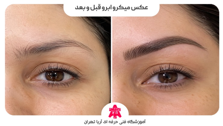 عکس میکرو ابرو قبل و بعد