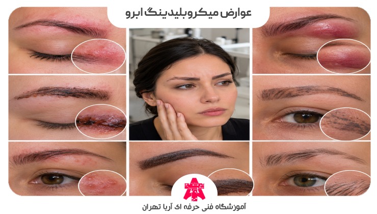 عوارض میکروبلیدینگ ابرو